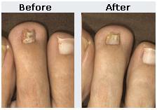 nail4
