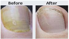 nail5
