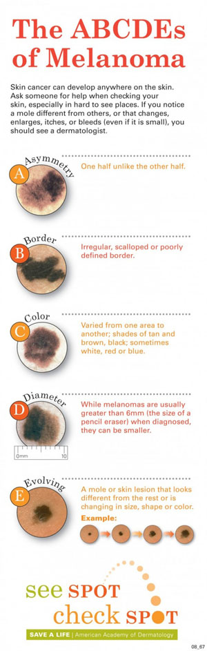 Skin cancer surgery