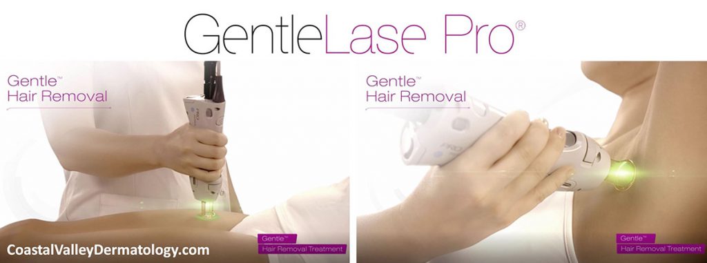 Laser Hair Removal Coastal Valley Dermatology