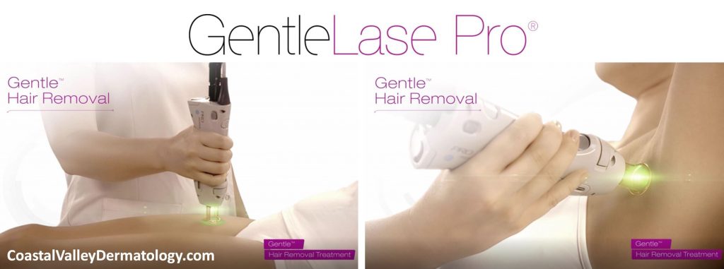 Laser Hair Removal - Coastal Valley Dermatology